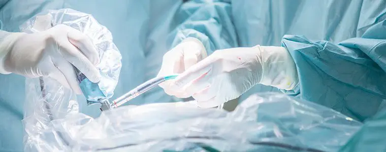 Cirurgia artroscópica no ombro tempo de recuperação Imagem